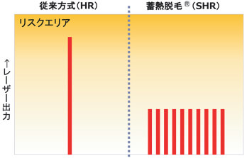 従来方式(HR)と蓄熱脱毛(SHR)のレーザー出力の比較