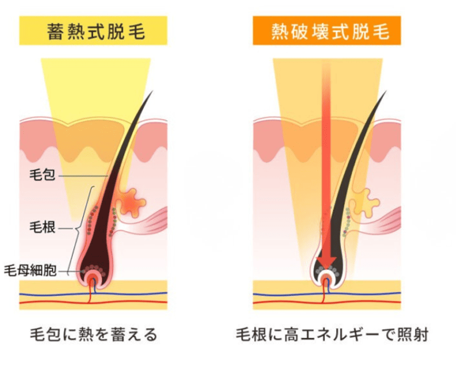 熱破壊式と蓄熱式の両方を搭載