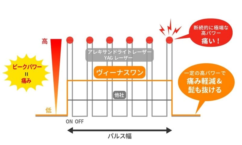 痛み軽減＆髭も抜ける